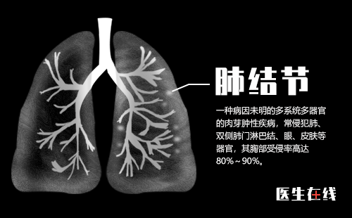 如何预防肺结节的发生？肺结节多久需要复查一次？