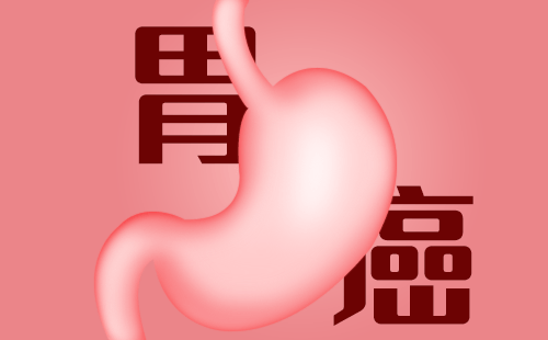 早期胃癌有什么症状