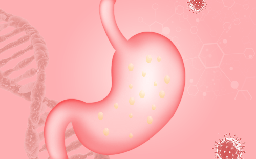 胃癌可以分为哪些类型？什么是多发胃癌？