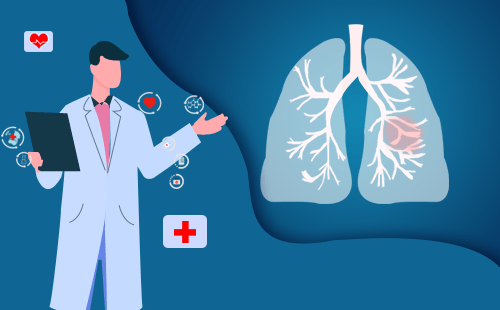 肺结核和肺癌，有什么关系么？