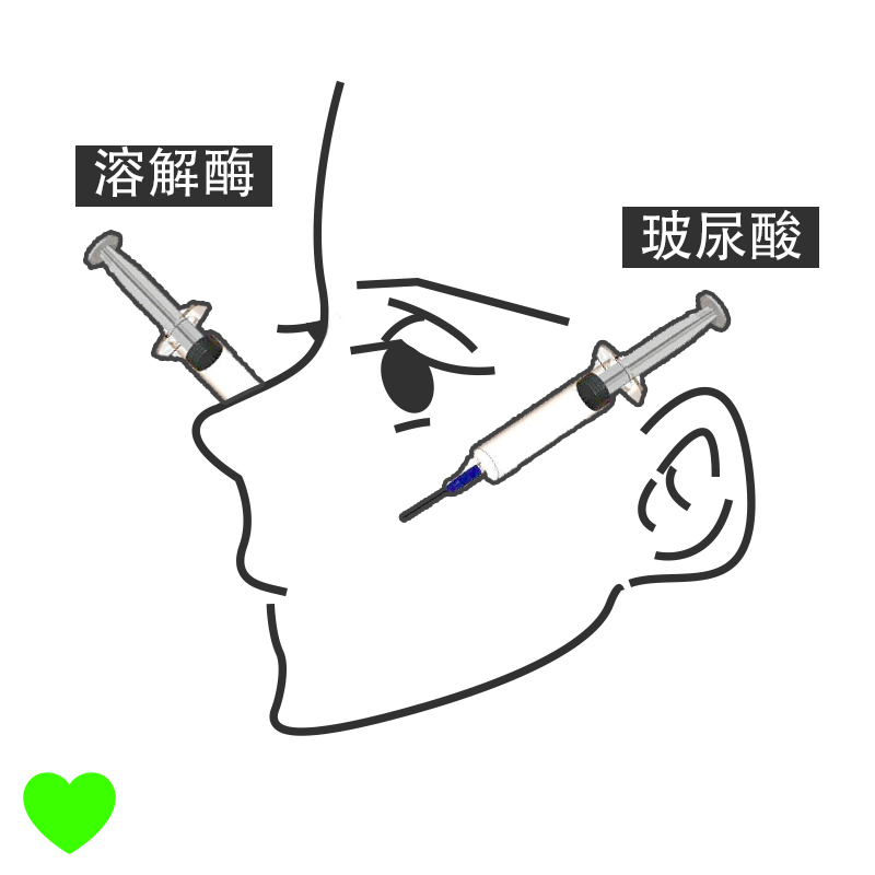 上海华美医疗美容医院怎么填充泪沟？