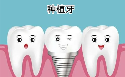 种植牙何时才能纳入医保？四川地区种植牙哪家医院做得好？