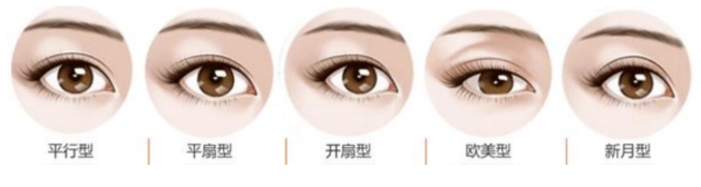 上海愉悦薇莱医疗美容医院做双眼皮埋线好还是割双眼皮好？